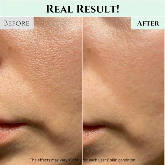 Beauty of Joseon Green Plum Refreshing Cleanser Gel Type Deep Pore Cleansing, Acne Face Wash, Blackhead Remover for All Skin Types, Korean Skincare 100ml, 3.38 fl.oz - Image 3