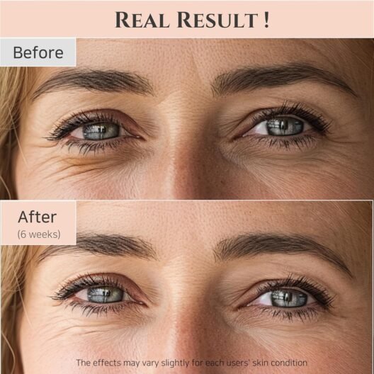 Beauty of Joseon Revive eye serum : Ginseng + Retinal, 30ml, 1fl.oz. - Image 8